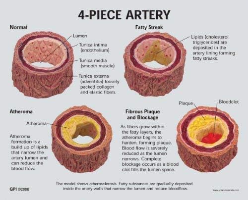 RRGJ Oktatási Modell, Közgyűlés Anatomicals 4-Darab Artéria Modell Emberi Test Anatómiai Mása Artéria Emléktábla Építsd Fel